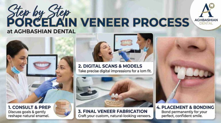 The Step by Step Porcelain Veneer Process at Aghbashian Dental